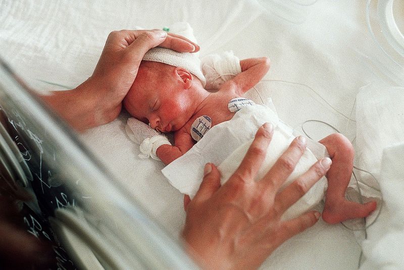 Fotografie (Nedonosené bábätko: Kedy doženie predčasný štart?)